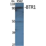 Western Blot - Anti-SLC4A11 Antibody (C18807) - Antibodies.com