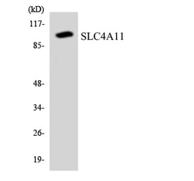 Western Blot - Anti-SLC4A11 Antibody (R12-3532) - Antibodies.com
