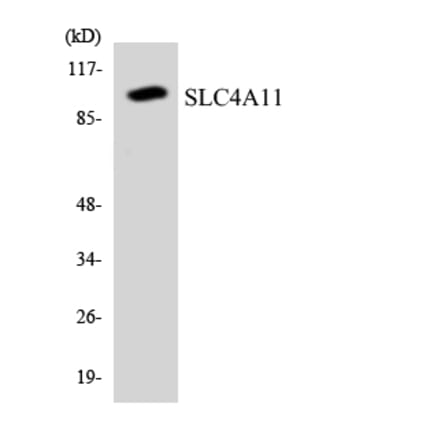 Western Blot - Anti-SLC4A11 Antibody (R12-3532) - Antibodies.com