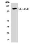 Western Blot - Anti-SLC4A11 Antibody (R12-3532) - Antibodies.com