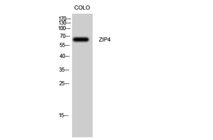 Western Blot - Anti-SLC39A4 Antibody (C19630) - Antibodies.com