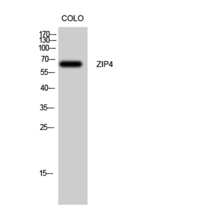 Western Blot - Anti-SLC39A4 Antibody (C19630) - Antibodies.com