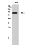 Western Blot - Anti-SLC39A4 Antibody (C19630) - Antibodies.com