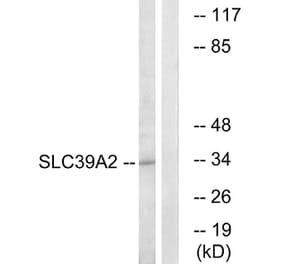 Western Blot - Anti-SLC39A2 Antibody (C19629) - Antibodies.com