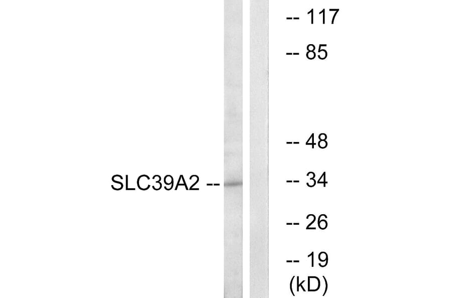 Western Blot - Anti-SLC39A2 Antibody (C19629) - Antibodies.com
