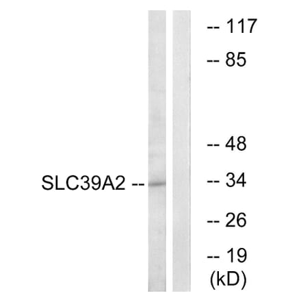 Western Blot - Anti-SLC39A2 Antibody (C19629) - Antibodies.com