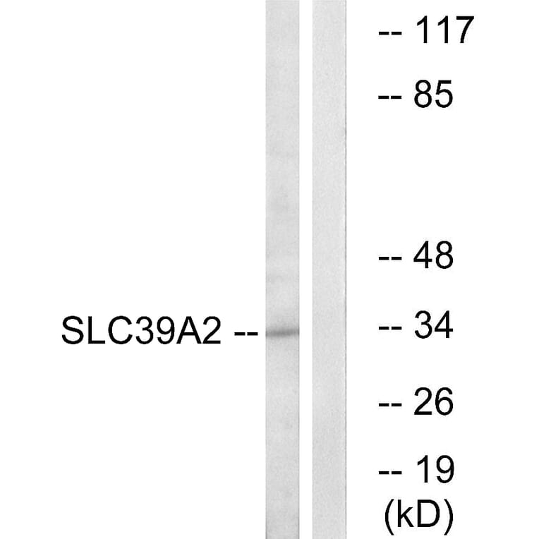 Western Blot - Anti-SLC39A2 Antibody (C19629) - Antibodies.com