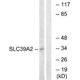 Western Blot - Anti-SLC39A2 Antibody (C19629) - Antibodies.com