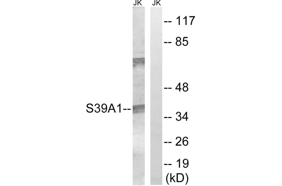 Western Blot - Anti-SLC39A1 Antibody (C19627) - Antibodies.com