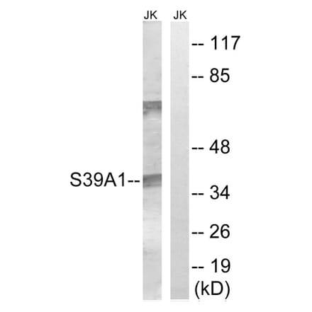 Western Blot - Anti-SLC39A1 Antibody (C19627) - Antibodies.com
