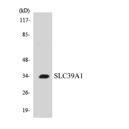 Western Blot - Anti-SLC39A1 Antibody (R12-3529) - Antibodies.com