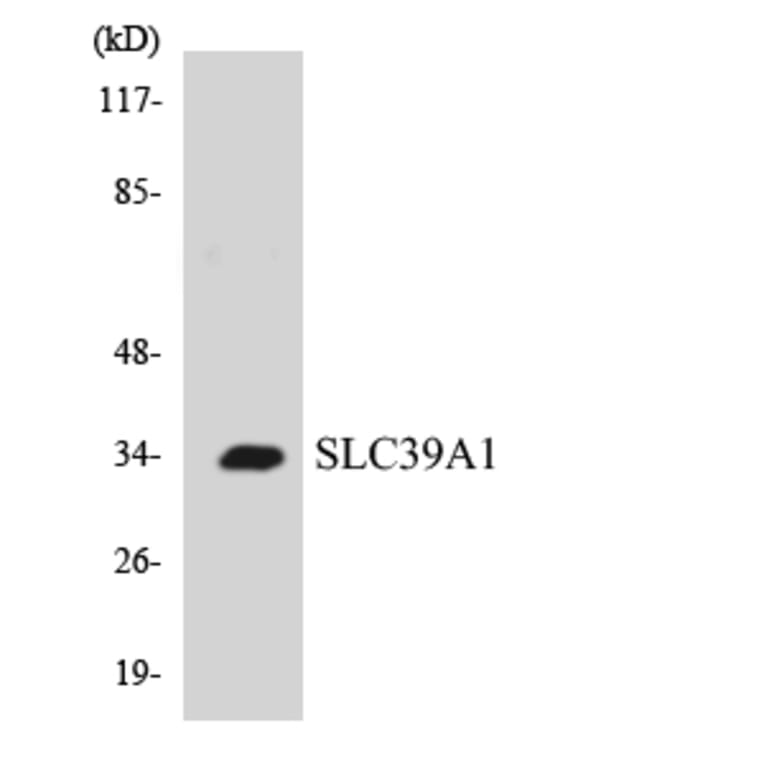 Western Blot - Anti-SLC39A1 Antibody (R12-3529) - Antibodies.com