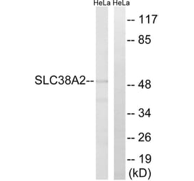 Western Blot - Anti-SLC38A2 Antibody (C20663) - Antibodies.com