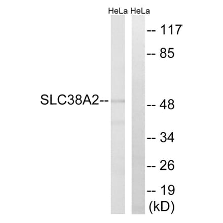 Western Blot - Anti-SLC38A2 Antibody (C20663) - Antibodies.com