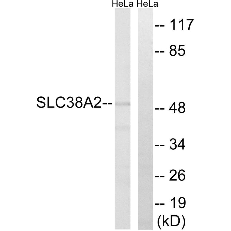 Western Blot - Anti-SLC38A2 Antibody (C20663) - Antibodies.com