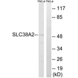 Western Blot - Anti-SLC38A2 Antibody (C20663) - Antibodies.com