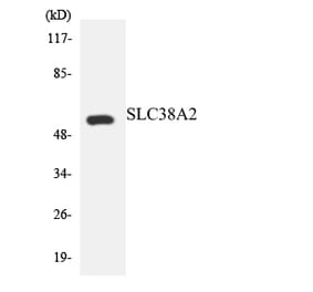 Western Blot - Anti-SLC38A2 Antibody (R12-3528) - Antibodies.com
