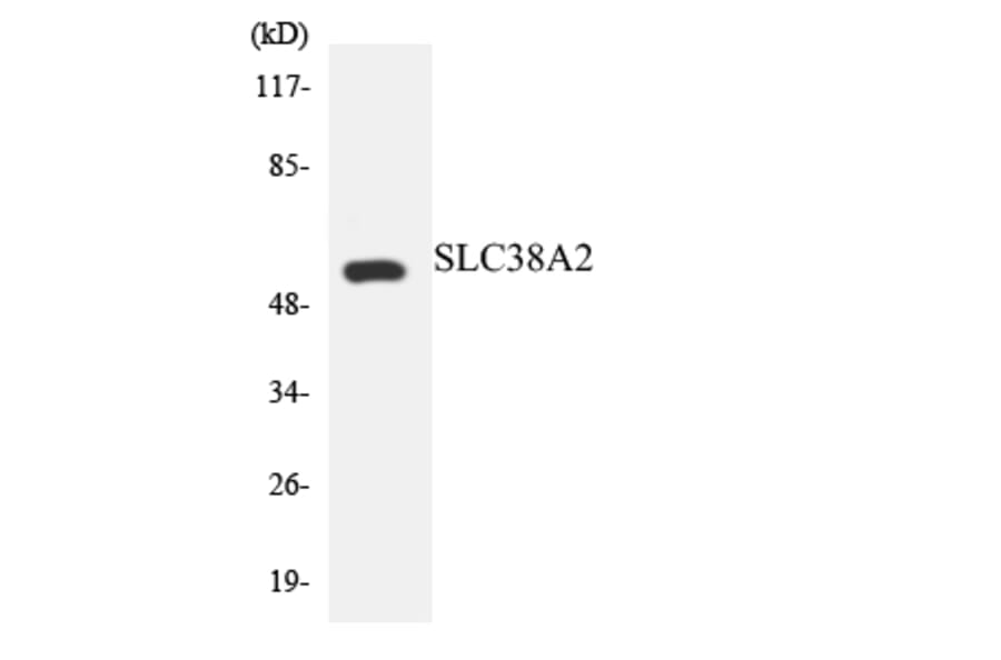Western Blot - Anti-SLC38A2 Antibody (R12-3528) - Antibodies.com