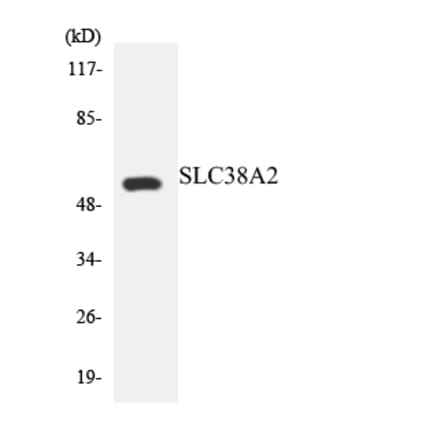 Western Blot - Anti-SLC38A2 Antibody (R12-3528) - Antibodies.com