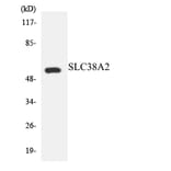 Western Blot - Anti-SLC38A2 Antibody (R12-3528) - Antibodies.com