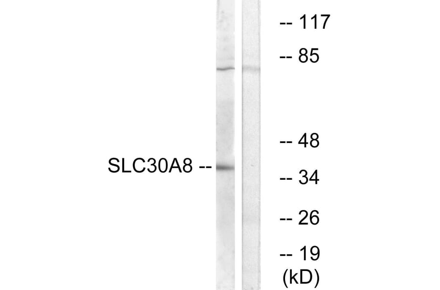 Western Blot - Anti-SLC30A8 Antibody (C19621) - Antibodies.com