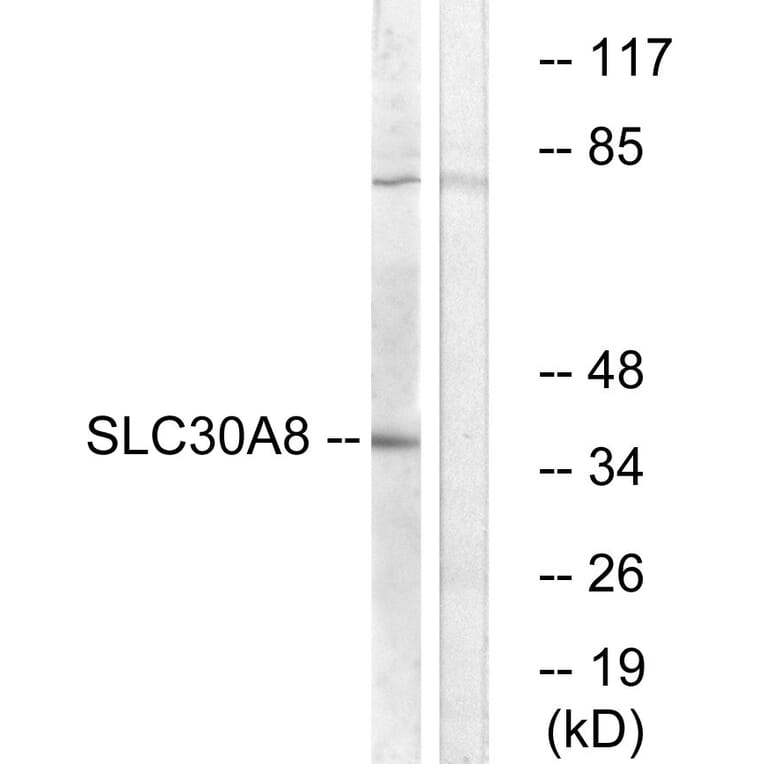 Western Blot - Anti-SLC30A8 Antibody (C19621) - Antibodies.com