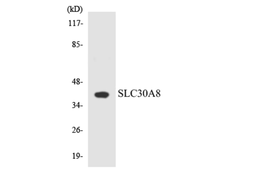 Western Blot - Anti-SLC30A8 Antibody (R12-3525) - Antibodies.com