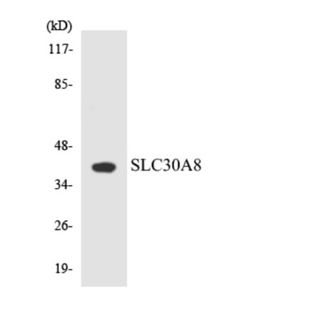 Western Blot - Anti-SLC30A8 Antibody (R12-3525) - Antibodies.com