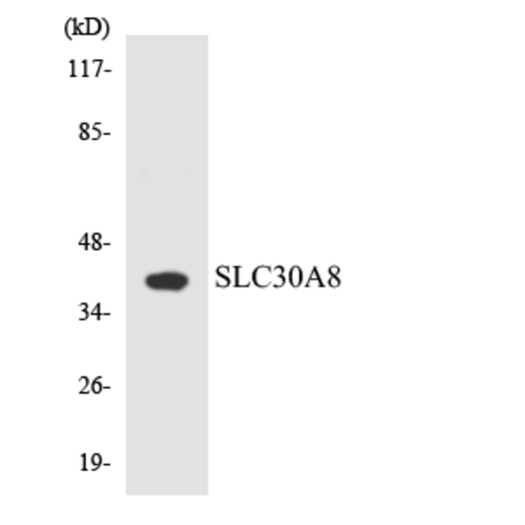 Western Blot - Anti-SLC30A8 Antibody (R12-3525) - Antibodies.com