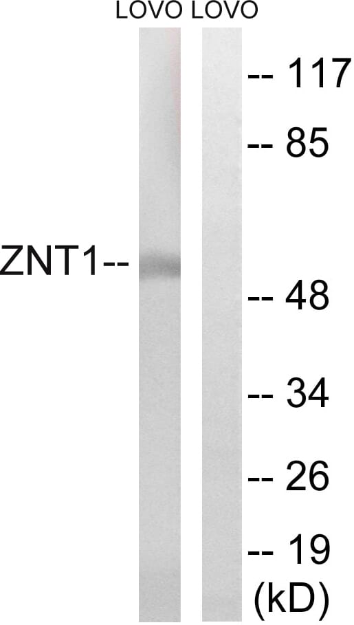 Western blot analysis of lysates from LOVO cells using Anti-SLC30A1 Antibody. The right hand lane represents a negative control, where the antibody is blocked by the immunising peptide.