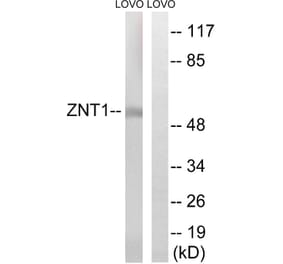 Western Blot - Anti-SLC30A1 Antibody (C19617) - Antibodies.com