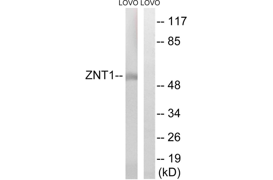 Western Blot - Anti-SLC30A1 Antibody (C19617) - Antibodies.com