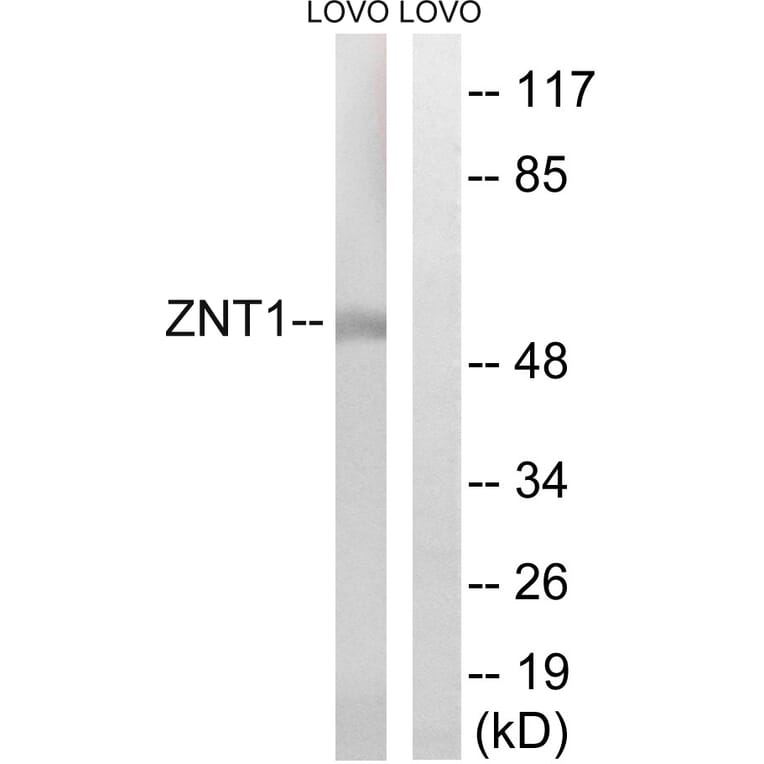 Western Blot - Anti-SLC30A1 Antibody (C19617) - Antibodies.com