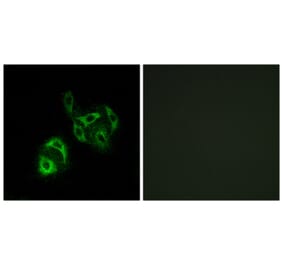 Immunofluorescence - Anti-SLC27A4 Antibody (C16490) - Antibodies.com