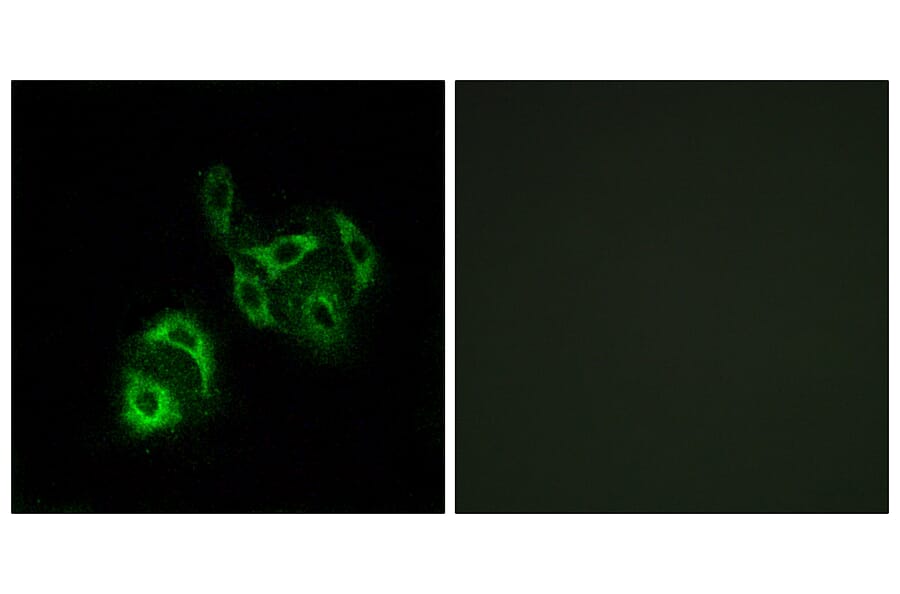Immunofluorescence - Anti-SLC27A4 Antibody (C16490) - Antibodies.com