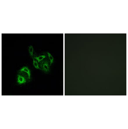 Immunofluorescence - Anti-SLC27A4 Antibody (C16490) - Antibodies.com