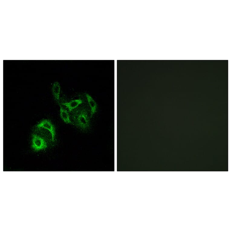 Immunofluorescence - Anti-SLC27A4 Antibody (C16490) - Antibodies.com