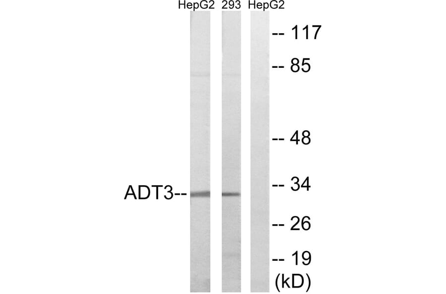 Western Blot - Anti-SLC25A6 Antibody (C14334) - Antibodies.com
