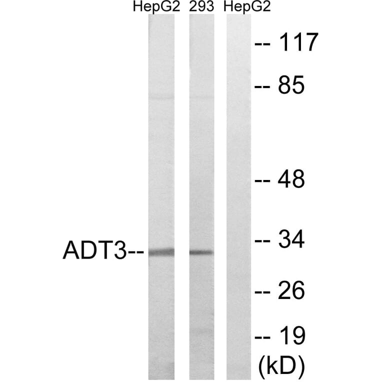 Western Blot - Anti-SLC25A6 Antibody (C14334) - Antibodies.com