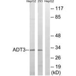 Western Blot - Anti-SLC25A6 Antibody (C14334) - Antibodies.com