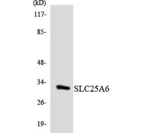 Western Blot - Anti-SLC25A6 Antibody (R12-3522) - Antibodies.com
