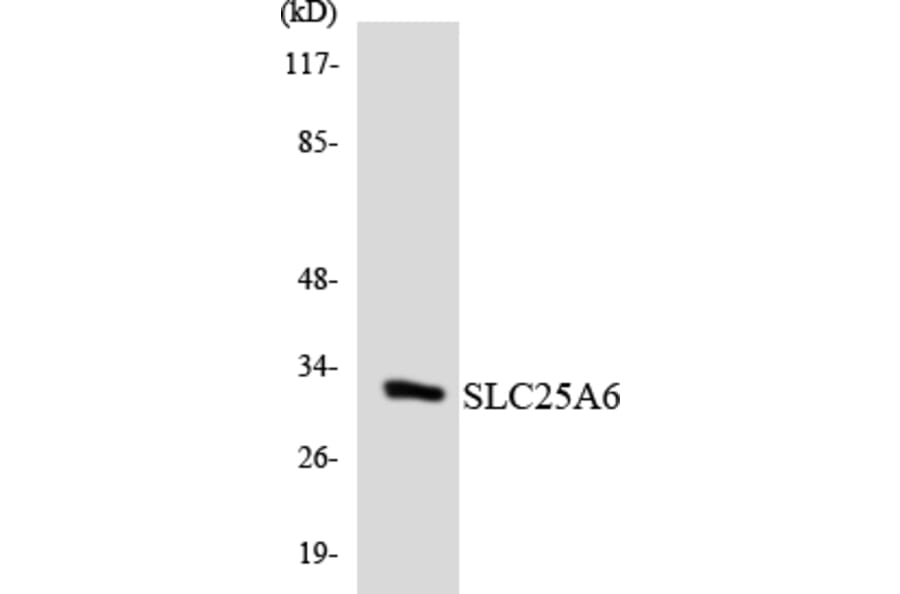 Western Blot - Anti-SLC25A6 Antibody (R12-3522) - Antibodies.com