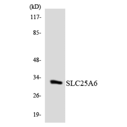 Western Blot - Anti-SLC25A6 Antibody (R12-3522) - Antibodies.com