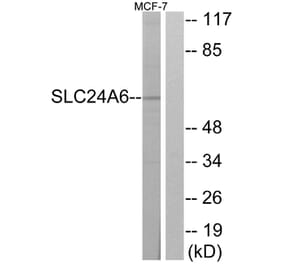 Western Blot - Anti-SLC24A6 Antibody (C18851) - Antibodies.com