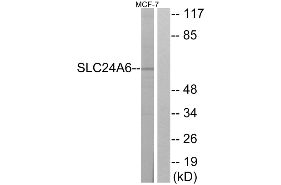 Western Blot - Anti-SLC24A6 Antibody (C18851) - Antibodies.com