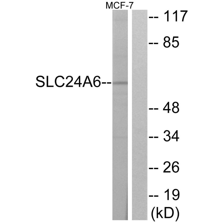 Western Blot - Anti-SLC24A6 Antibody (C18851) - Antibodies.com