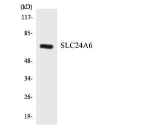 Western Blot - Anti-SLC24A6 Antibody (R12-3519) - Antibodies.com