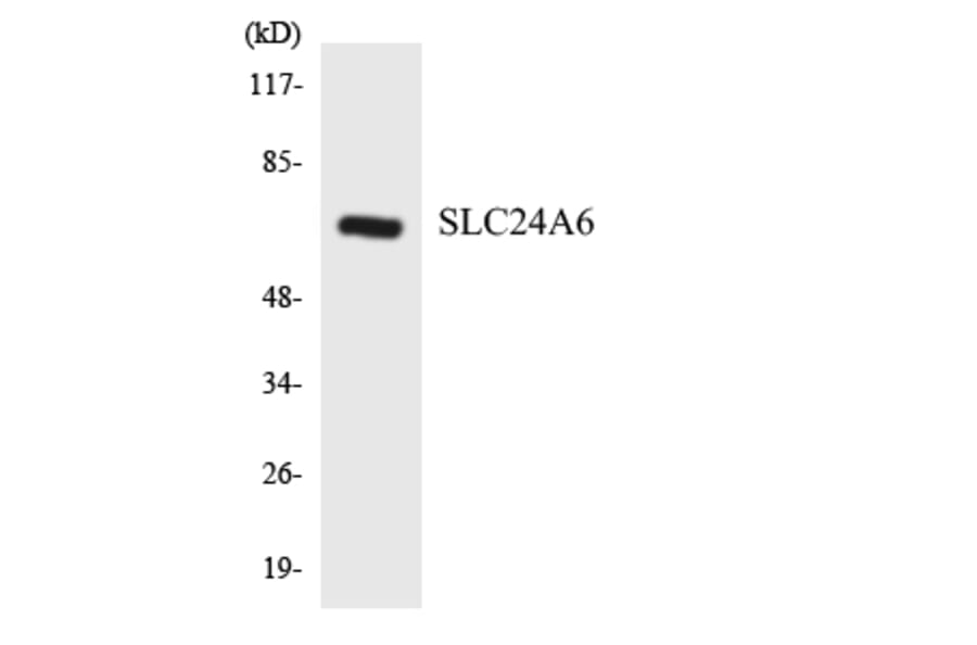 Western Blot - Anti-SLC24A6 Antibody (R12-3519) - Antibodies.com