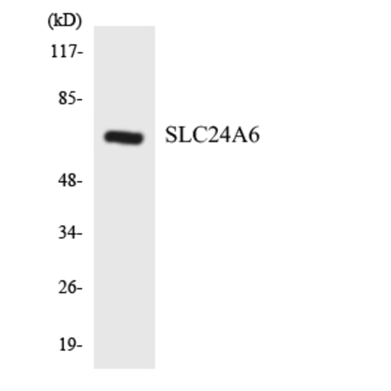 Western Blot - Anti-SLC24A6 Antibody (R12-3519) - Antibodies.com
