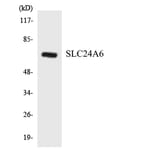 Western Blot - Anti-SLC24A6 Antibody (R12-3519) - Antibodies.com